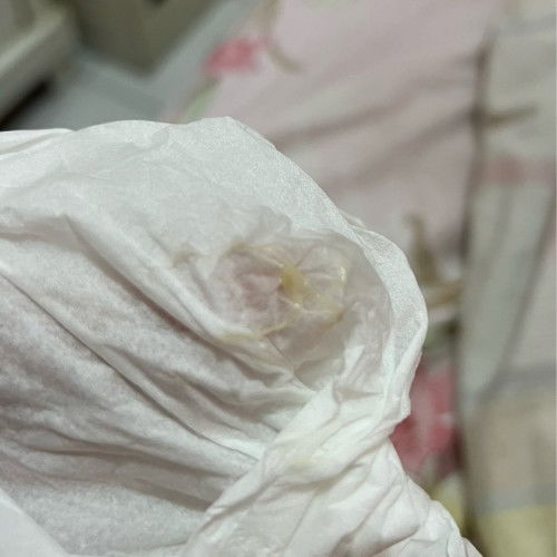 Keputihan saat hamil