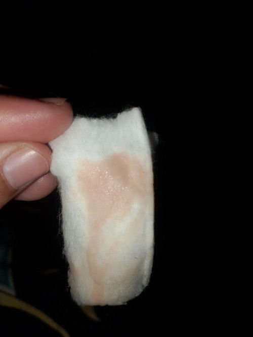 ออกแบบนี้มา3-4วันกลิ่นเหมือนน้ำคาวปลาแล้วมีอาการท้องแข็ง ปวดท้องเหมือนมาประจำเดือน