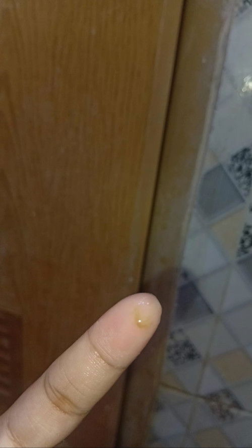 Hamil 9minggu mengalami kecoklatan dan kram perut