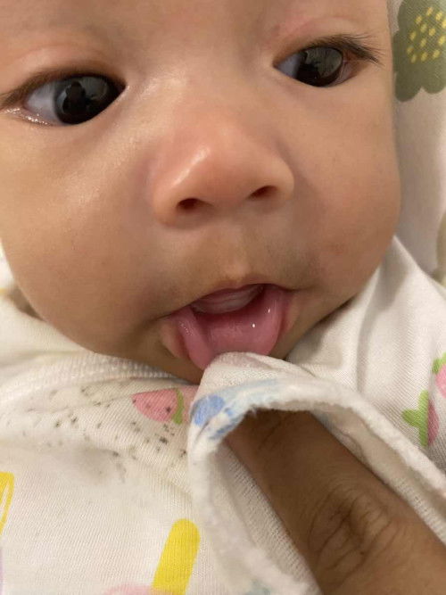 แบบนี้ใช่ฟันน้องกำลังจะขึ้นไหมคะแม่ๆ