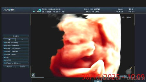 Tuần 38 mà bé đạp nhiều hơi đau bụng có phải dấu hiệu chuyển dạ không các mon.