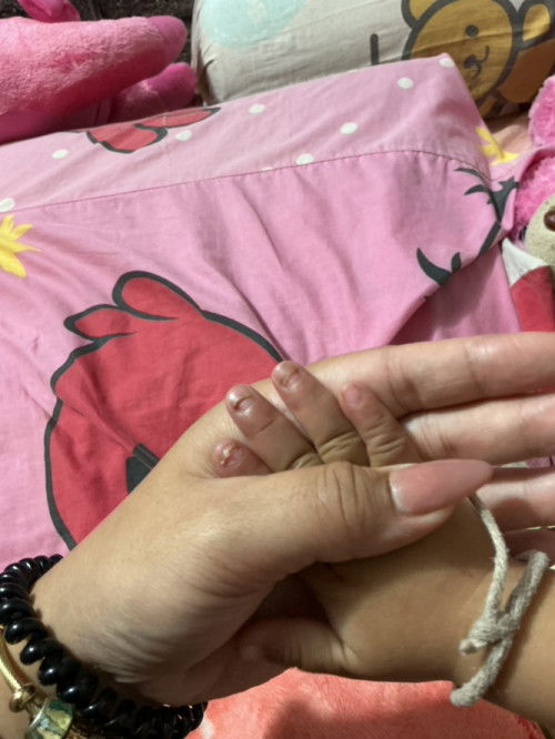 ทำไมเล็บเป็นแบบนี้