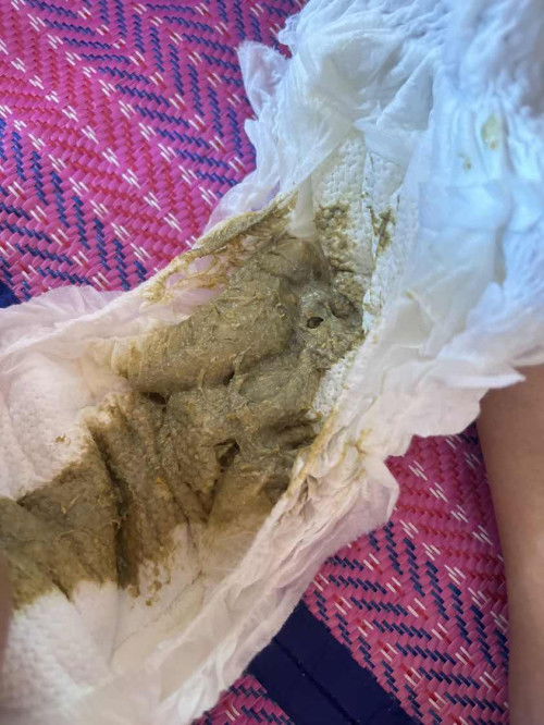 สอบถามแม่ๆค่ะ