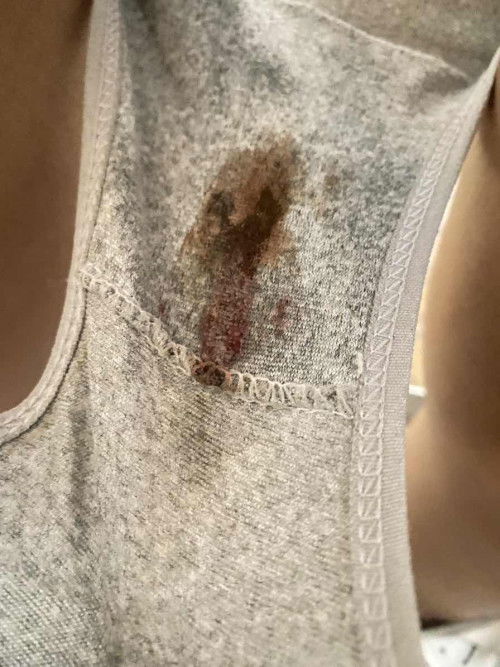 นี่คือเลือดล้างหน้าเด็กหรือเลือดประจำเดือน