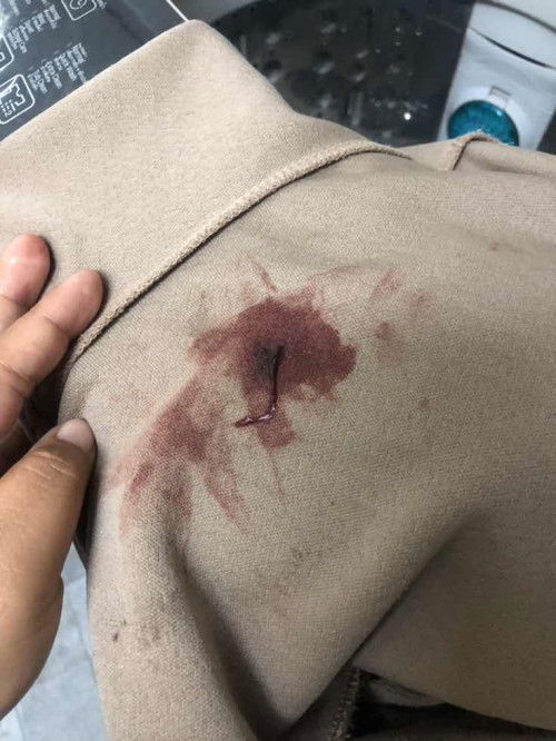 เลือกออกตอนตั้งครรภ์