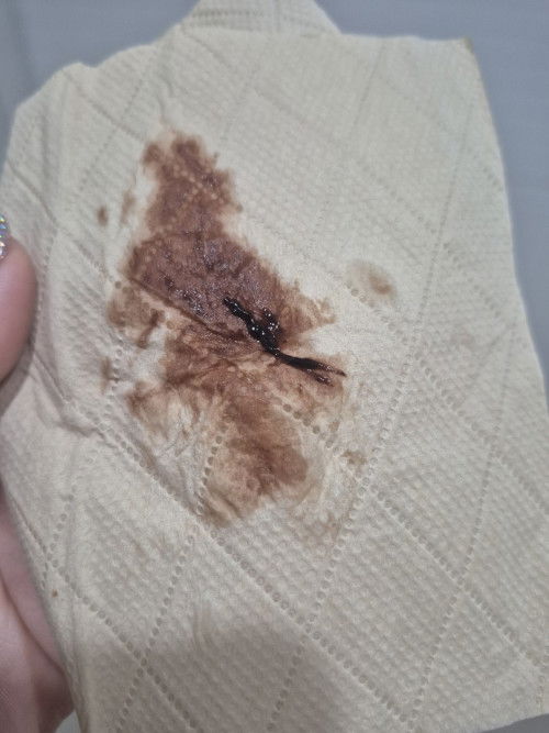 มีเลือดสีน้ำตาลออก