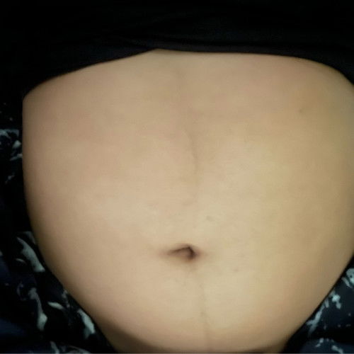 ท้องเเรก14+1w