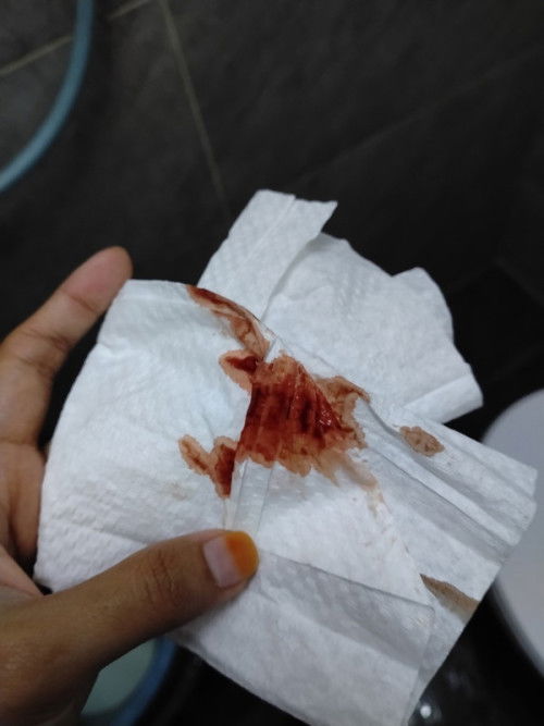 Maaf sgt2 kalau geli nak tnya ni normal ke , sedih sgt2 sy risau 😔