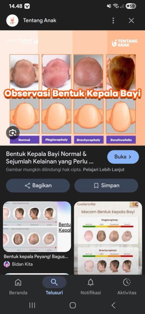 kepala anaku peyang seprti gambar ke 2 dri kiri, posisi tidur yg benar itu miring kanan/kiri ya bun?
