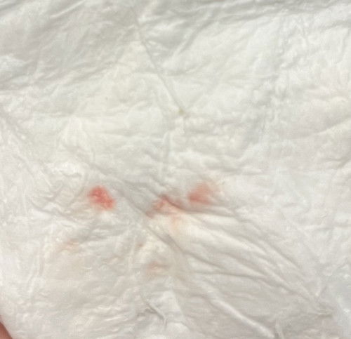 ปกติมั้ยค่ะแม่ๆ ไม่เคยเป็นแบบนี้