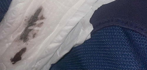 อยากสอบถามคะ ว่าคือเลือดล้างหน้าเด็กป่าวคะ หรือเป้นอะไรคะ เป็นห่วงน้องคะ 
มากระปริกะปอย 2วันแล้วคะ สีนํ้าตาลเลือดนิดหน่อย