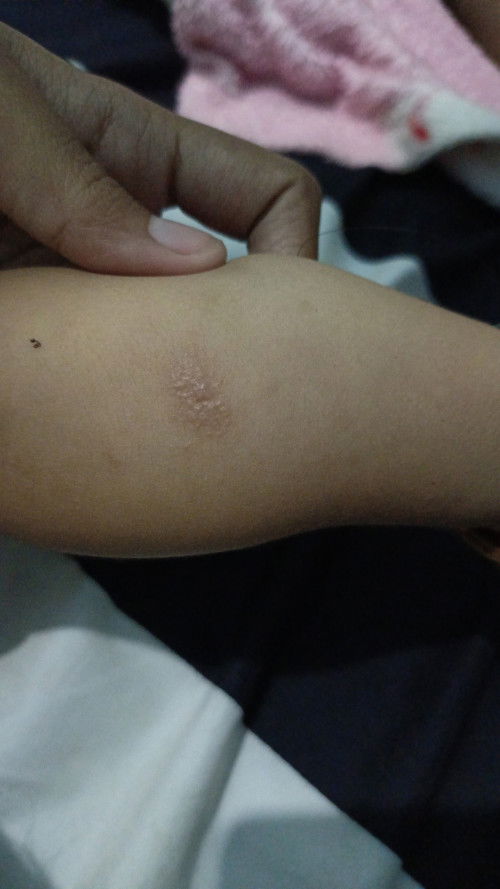 GatalMau tanyanya bun ini sakit apa dan obatnya apa ya untuk bayi udi 7 bulan???