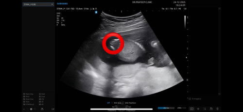 แม่ๆคิดว่าเพศไหนค่ะ