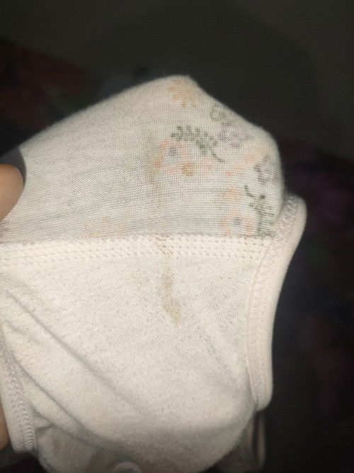 Keputihan atau flek ya?