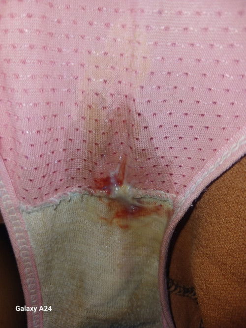 แบบนี้ต้องไปหาหมอไหม