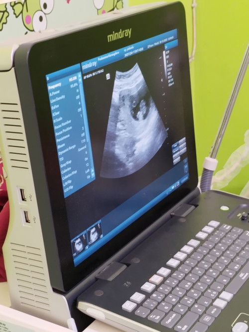 Maren baru ajj USG di puskesmas, katanya sih ini kembar. Emng iya ya?