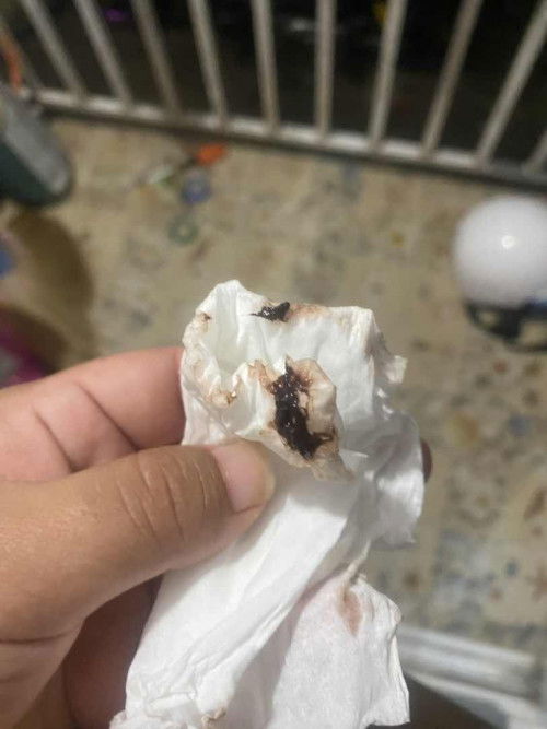 กังวังใจค่ะแม่ๆ ให้คำปรึกษาหนูหน่อยนะคะหนูท้องลูกคนแรก😢🙏🏻