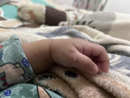 tangan bayi bentol bernanah