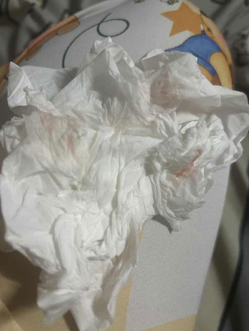 ท้อง 24+4w มีเลือดออกแบบนี้อัตรายไหมคะ