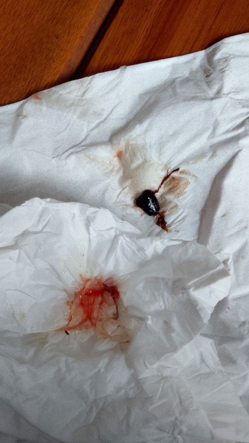 Keluar Lendir 39+3
hpl 5 januari