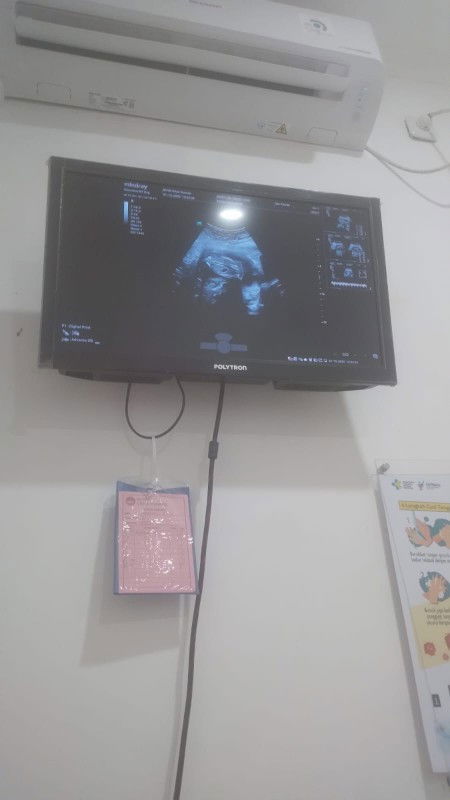 Udah excited bgt buat USG di bulan kemarin, ehh pak suami motoinnya malah kaya gini hasil 'y🥲