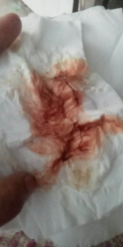 สอบถามแม่ๆค่ะ