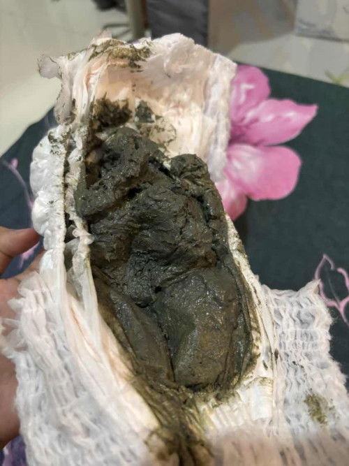 pup ambyar atau normal