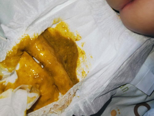 ถ่ายเป็นเมือก