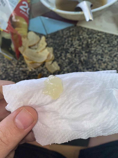 มูกใสแบบนี้ไปโรงบาลได้เลยมั้ย 39+2 วีค