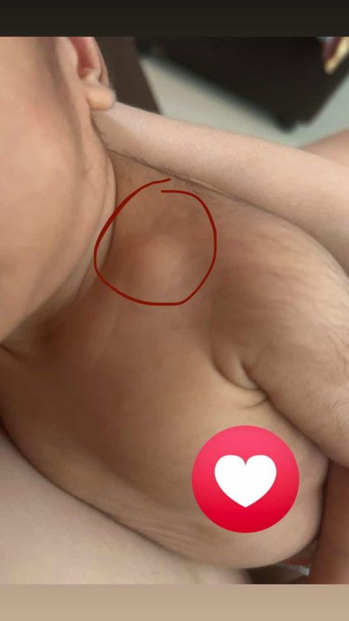 Buto between neck and shoulder