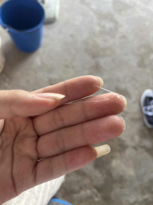 ท้อง29+3 หลังปัสสาวะเสร็จพอเช็คมีอันนี้ออกมามันคืออะไรคะไม่มีกลิ่นไม่ปวดท้อง