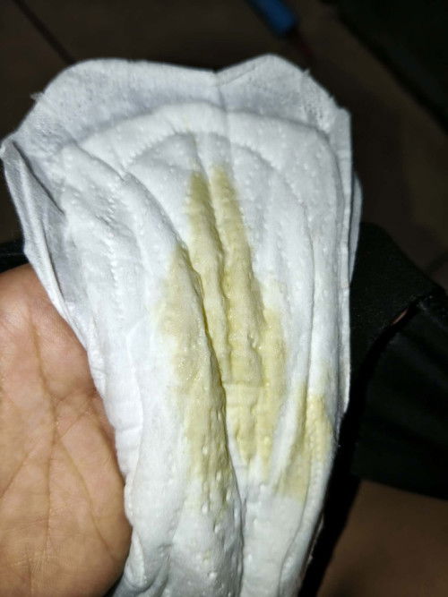 สอบถามหน่อยค่ะแม่ๆ