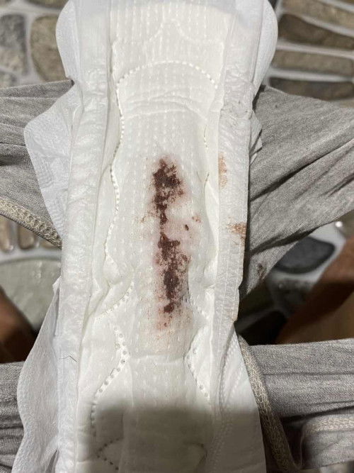 แบบนี้คือเลือดล้างหน้าเด็กไหมคะ