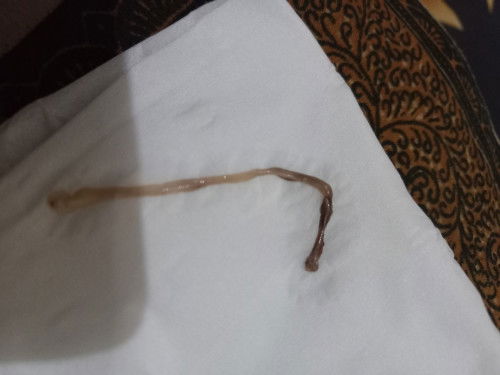 Bunda.... tengah malam dibuat galau, pipis tiba² keluar kayak gtu usia 9w6d 
Itu apa ya?