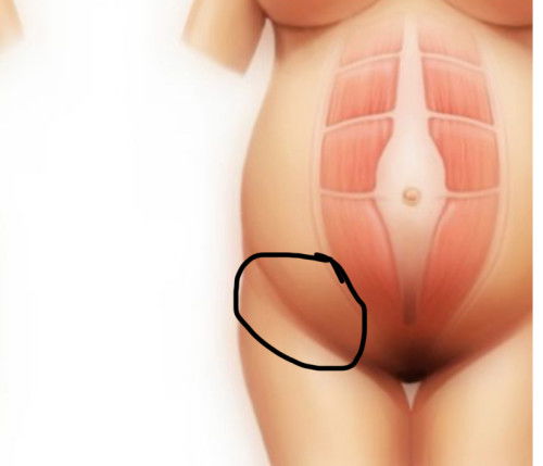 ปวดท้องด้านขวา