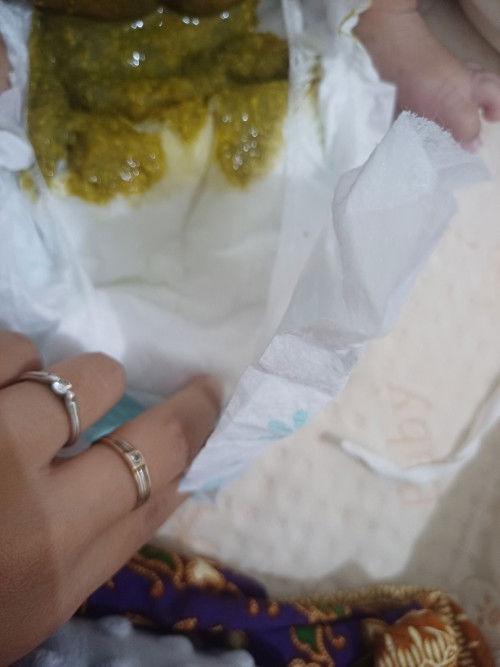 Bab hijau normal atau tidak