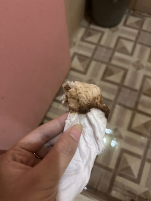 hamil 14 minggu flek