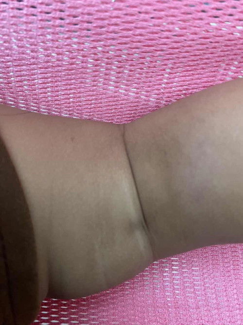 น้องอายุ10เดือน 24 วัน