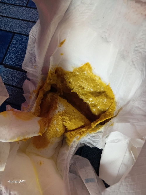 สีอึแบบนี้ปกติไหมค่ะ