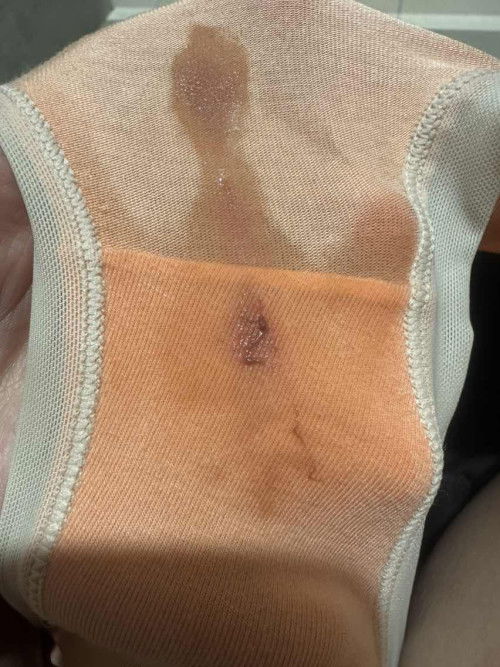 Lendir brownish tanda apa ya