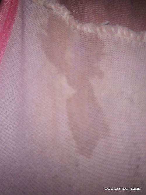 Hamil 24minggu knpaa yh itu aku jadi overthinking