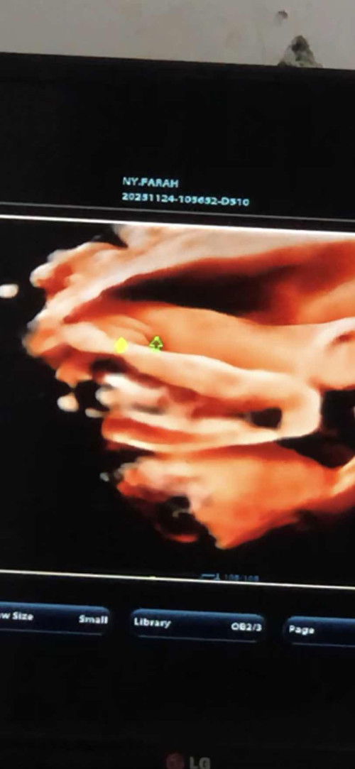 Ini fix perempuan gak ya