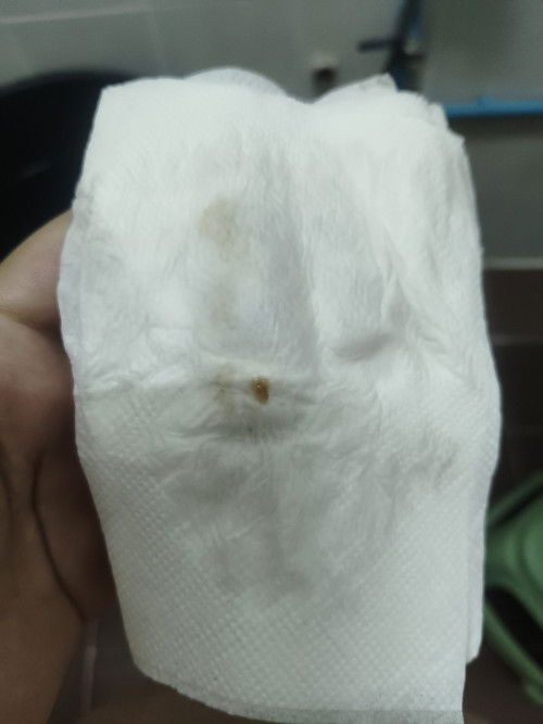 ขอคำแนะนำและปรึกษา