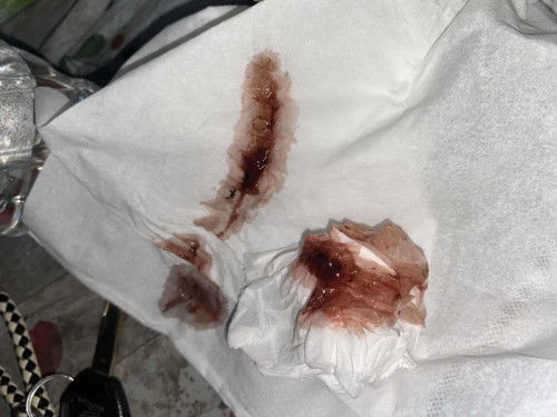 Hamil BO,9 week keluar flek seperti haid