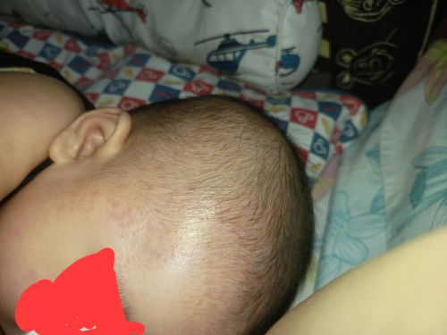 Milk allergy              !!??