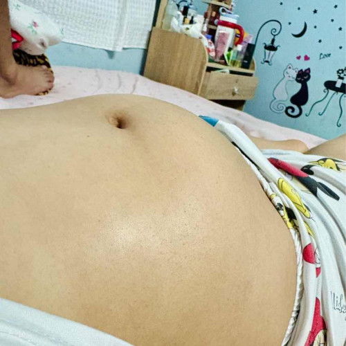 5เดือน ท้องเล็กไปไหมคะ