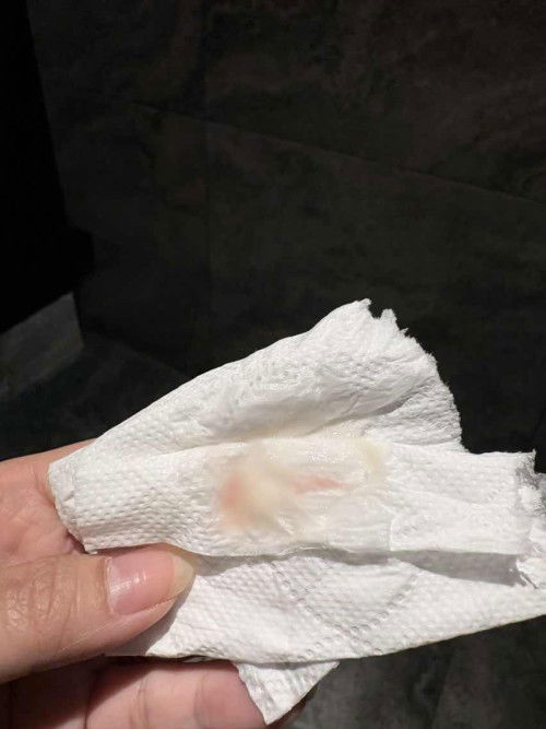 Lendir ni jenis sedang penempelan ke? Help