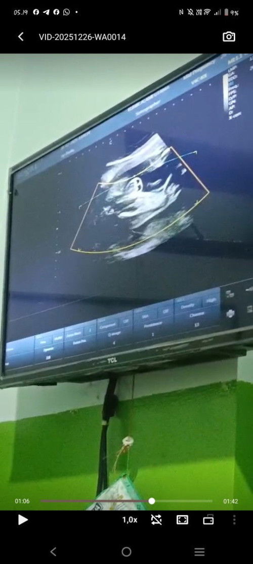 Hsil USG cowok/cewek