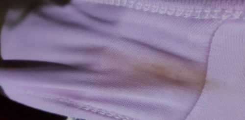 Maaf fulgar,bun ini termasuk nya flek atau keputihan ya ? Aku hamil 6week kira" bahaya atau ga ya?