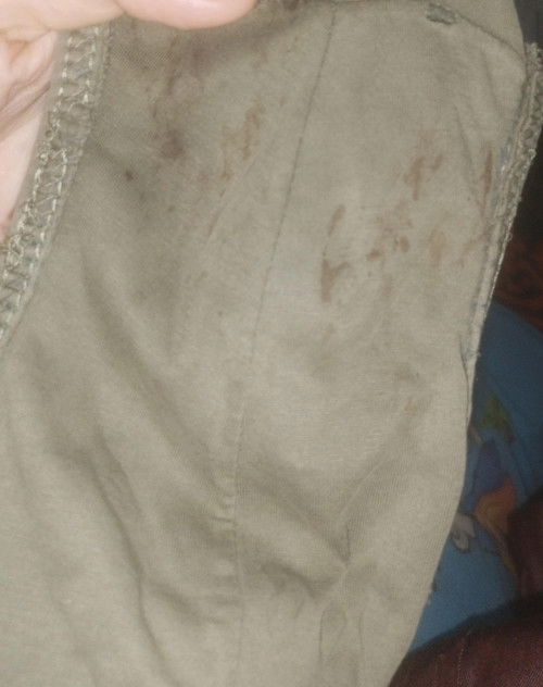 HAMIL 8 MINGGU ADA BERCAK COKLAT